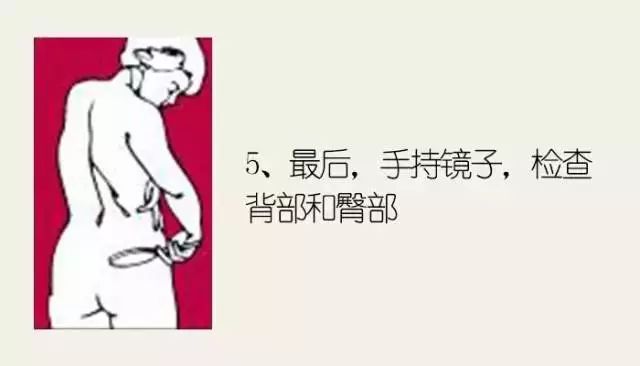 黑色素痣病理检测鳞状上皮病变,什么样的痣需要做病理