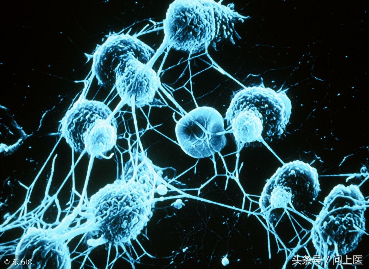 免疫球蛋白a偏高和补体c3偏低,免疫球蛋白检测结果高