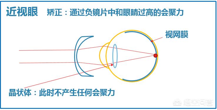 晚上如何远眺防近视,为什么远眺有助于预防近视
