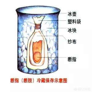 不小心被烟花伤到手了怎么办,不小心被炮竹伤到眼睛怎么办