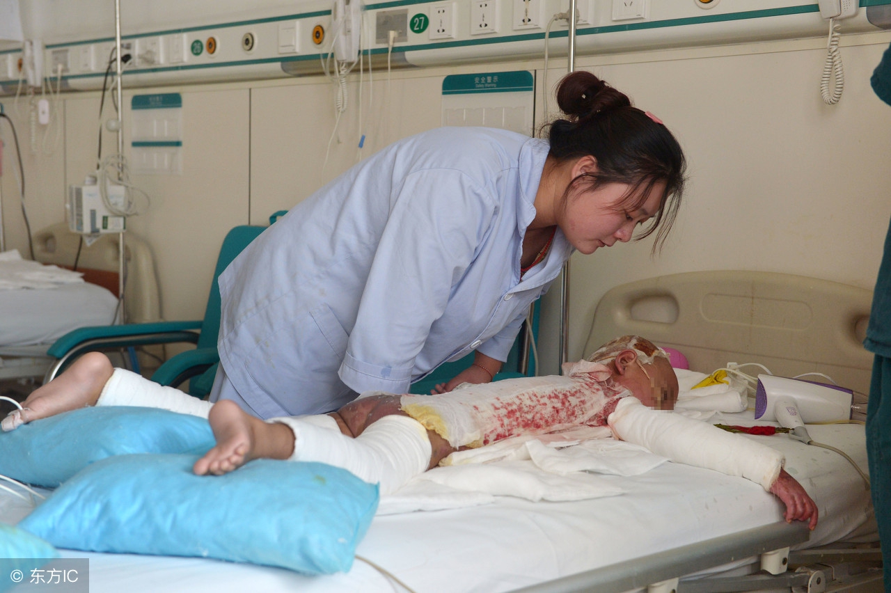 女婴被开水烫伤怎么办,25天新生儿被开水烫伤