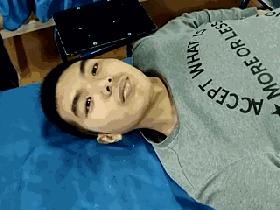 哈尔滨小儿推拿斜颈哪个地方好,小儿斜颈推拿的治愈率有多高