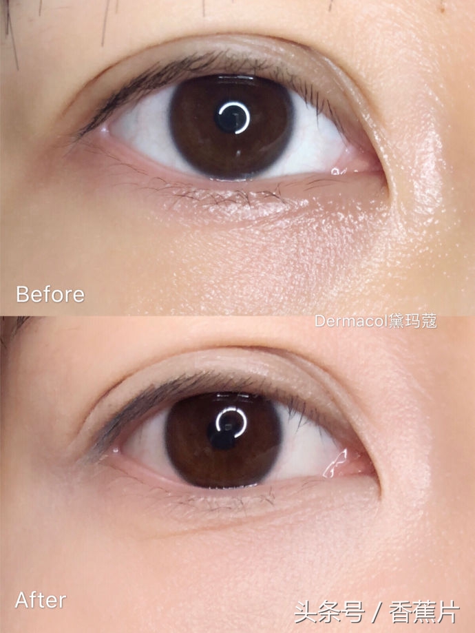 遮瑕真实测评程十安,遮瑕青色黑眼圈熊猫眼