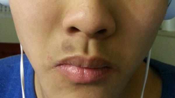 流感好了感觉不快乐,流感好了不想吃饭