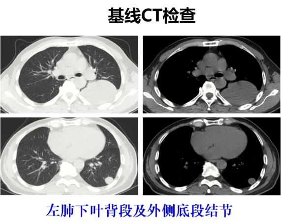 华莹奇医生援鄂了吗,华莹奇