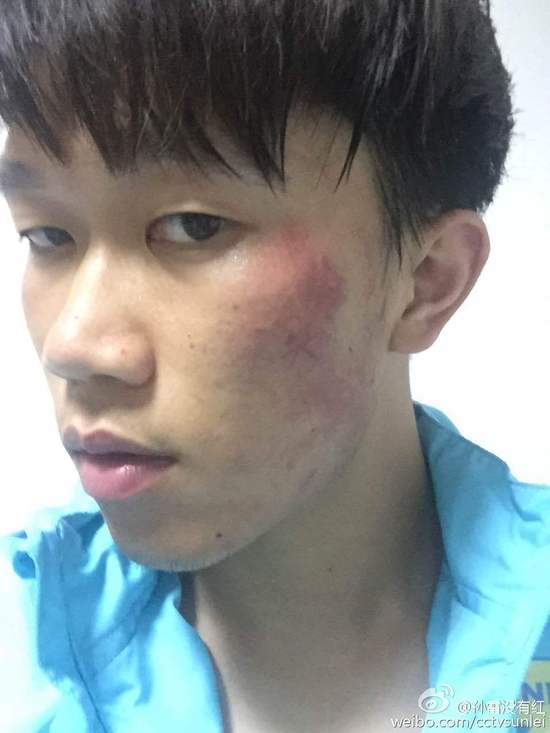 苏宁足球被打,江苏苏宁球员和对方发生冲突