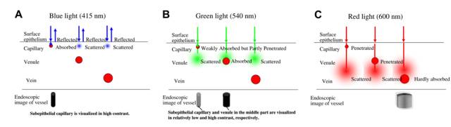 内镜检查痛苦吗,内镜检查是怎么做的
