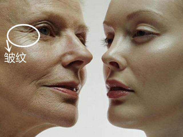 24岁法令纹克星一览表,抬头纹法令纹鱼尾纹抗皱克星