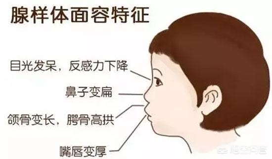 孩子睡不好很容易被忽视,孩子睡觉打鼾是什么原因怎么解决