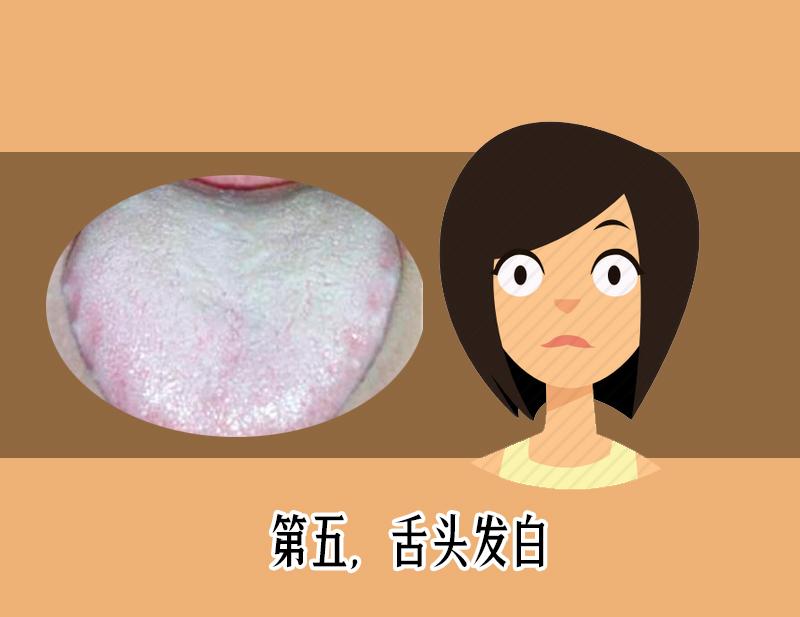 舌苔发黑辨证,舌苔整体发黄警惕四种原因