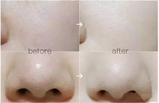 drjart蒂佳婷bb霜10毫升,drjart蒂佳婷bb霜开壳