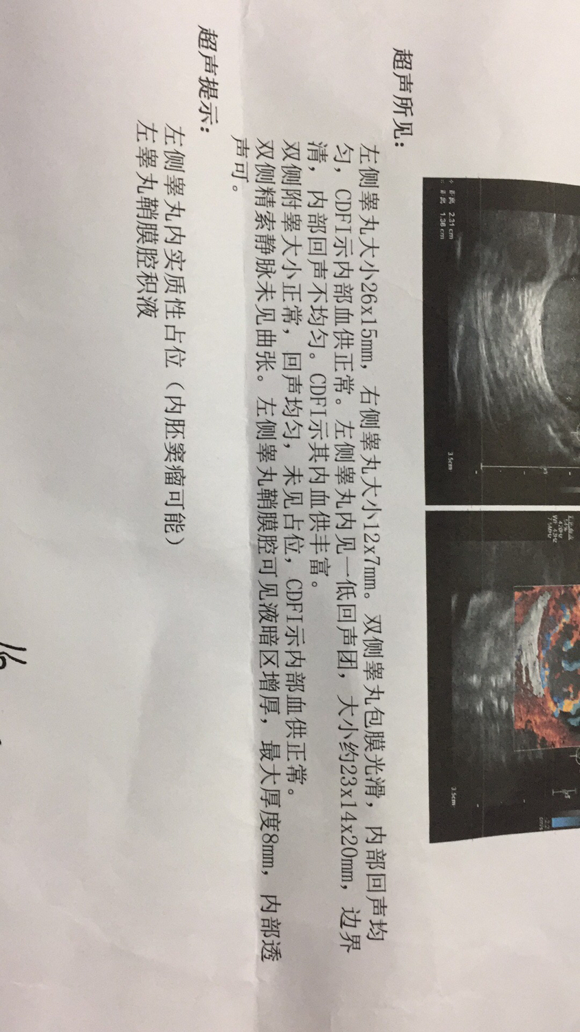 8个月的孩子被查出来，内胚窦瘤，做父母的心是这样的？