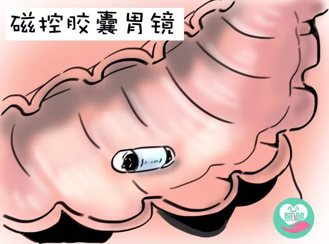 听说你害怕做胃镜？这篇特地写给你哦~