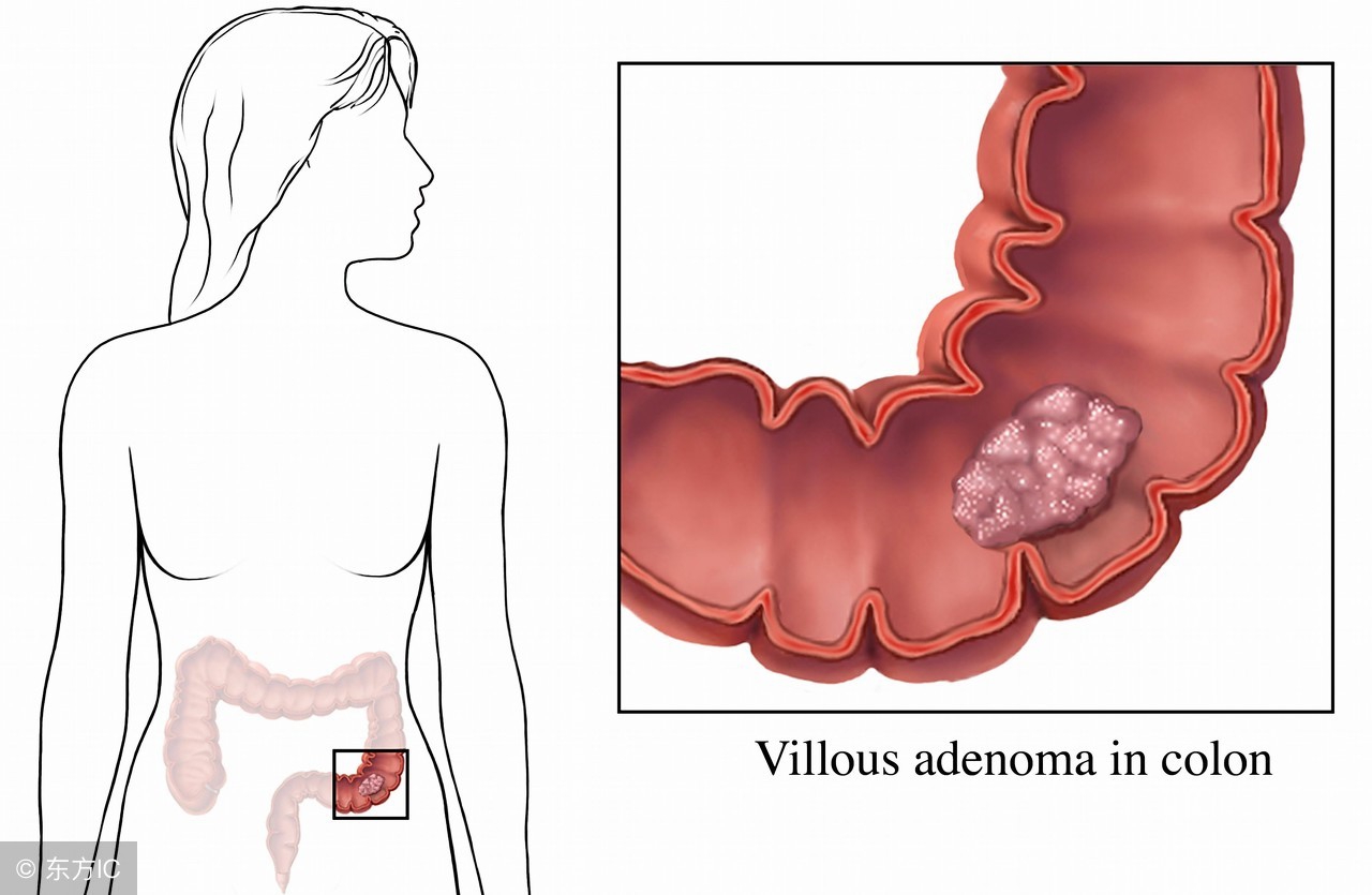 影响患者生存期10大因素，最后一点说得太对了！