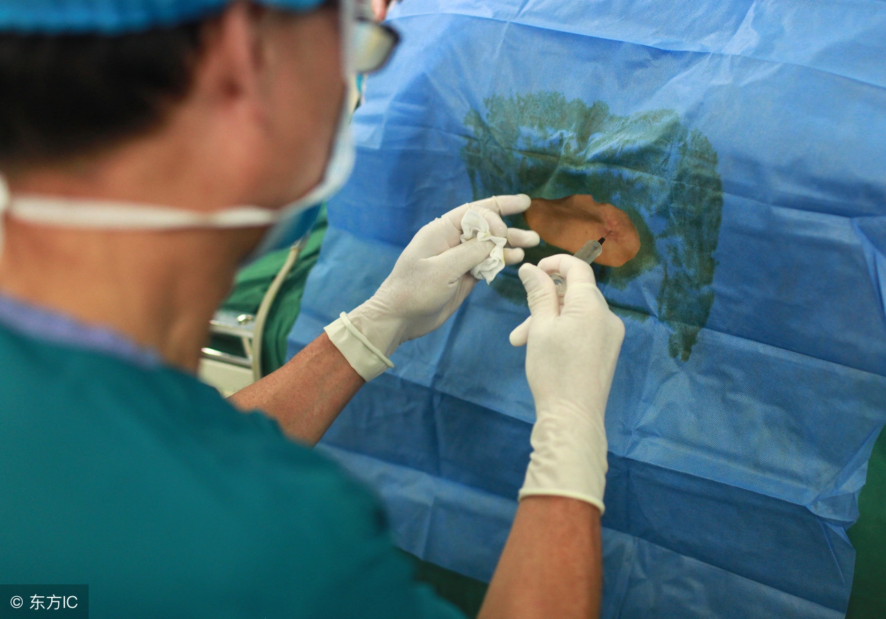 女性做剖腹产手术有什么风险?