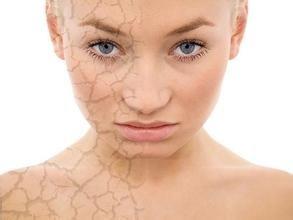 护肤小知识皮肤缺水的警告,护肤带你了解四大皮肤问题