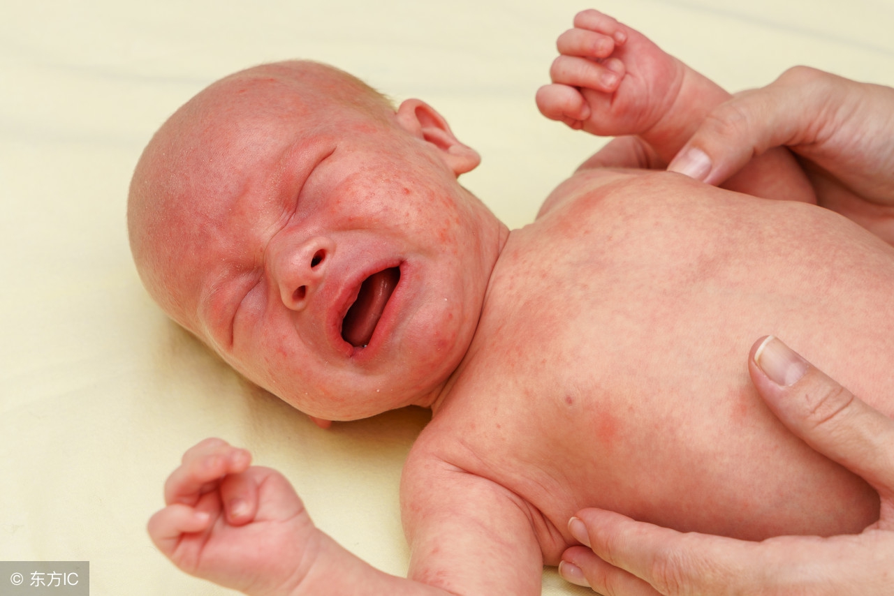 新生儿脸上长满了小红点怎么回事,新生儿脸上头上起了好多小红点