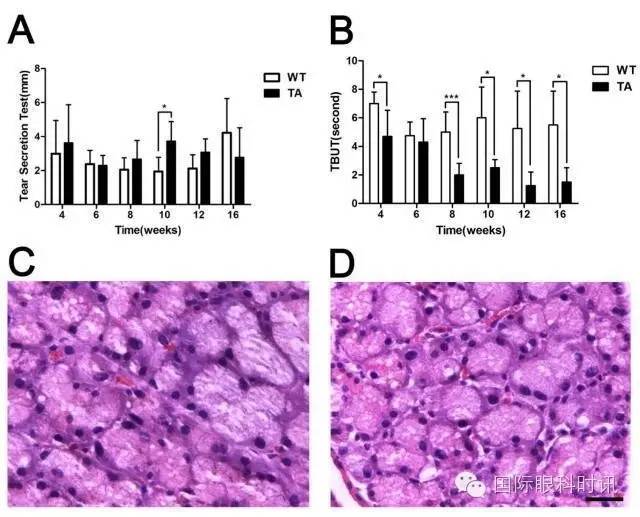 角膜会2016李炜教授:EDA基因突变鼠:一种新的睑板腺功能障碍相关性干眼动物模型