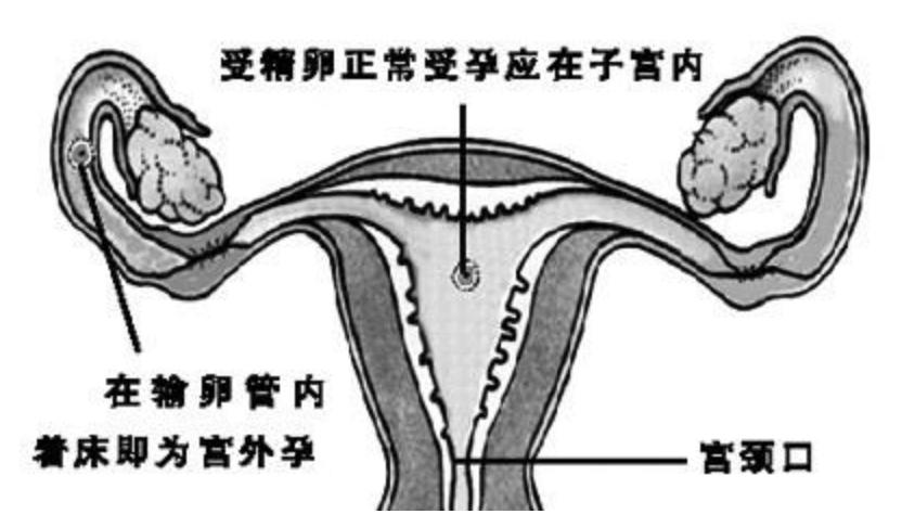 女子怀上双胞胎完整版,女子怀了双胞胎却只生下一个女儿