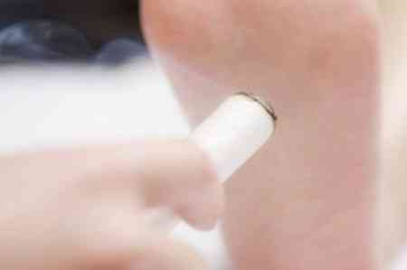 睡不够老是困艾灸哪个穴位,腰困怕冷艾灸哪个穴