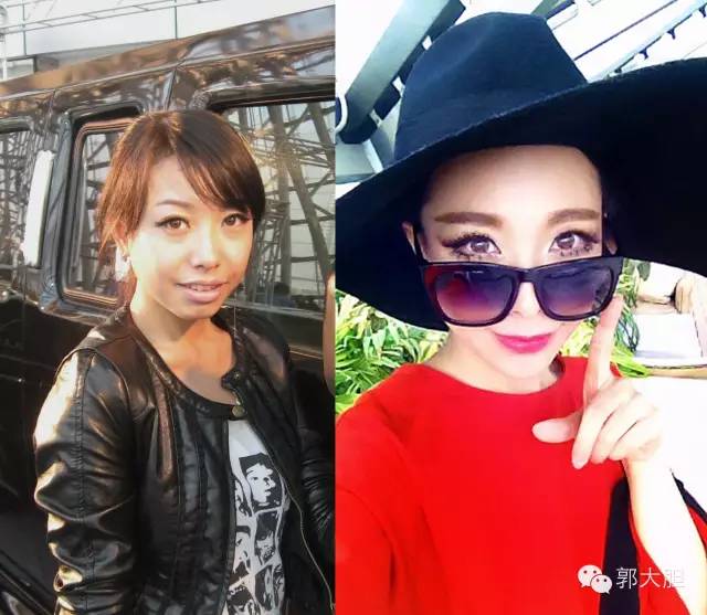 第一次整容日记,整容日记最经典的一段