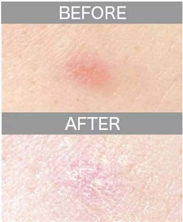 遮瑕膏排行榜10强混合皮肤,比较不错的三色遮瑕膏推荐