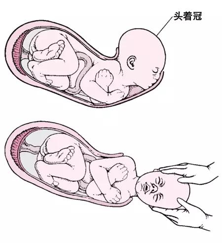 准妈妈分娩后要保留孩子脐带血吗,产房准妈妈必备物品清单