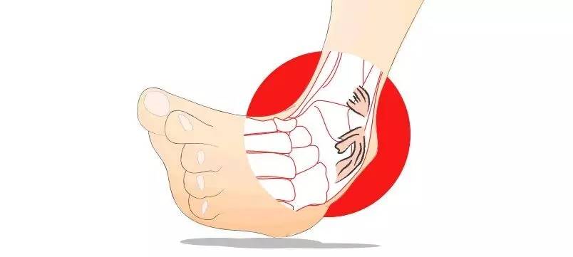 有的人为了残奥会去截肢,有些情况为什么要截肢