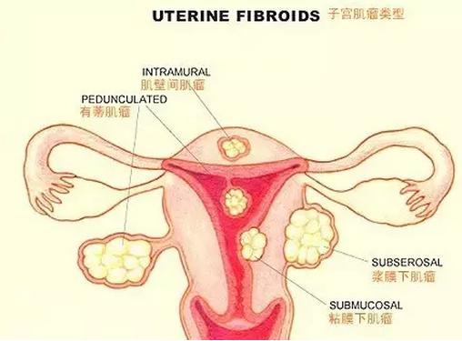 卵巢老一岁，女人老十岁，女人的下面有多脏你知道吗！