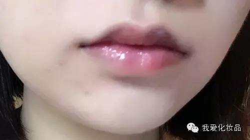 油皮痘肌适合的护肤品牌子,混油皮痘肌适用的护肤品推荐