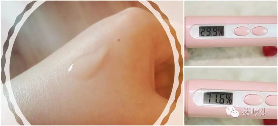 可涂是什么,可涂抹可注入玻尿酸