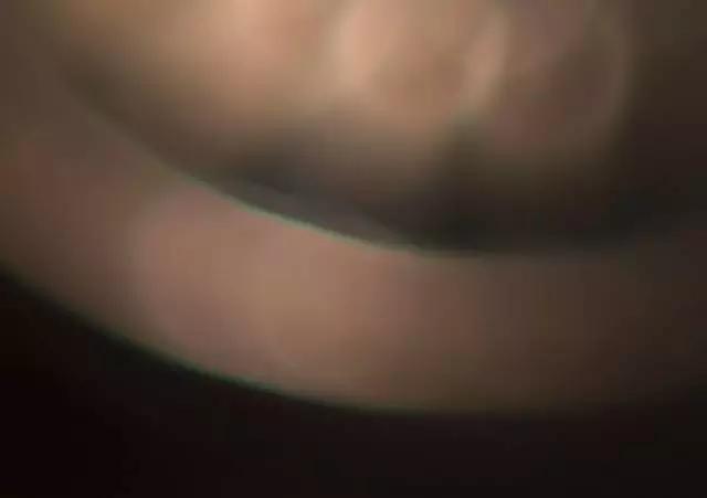 后期从ACR学起第28条:颜色去除色差