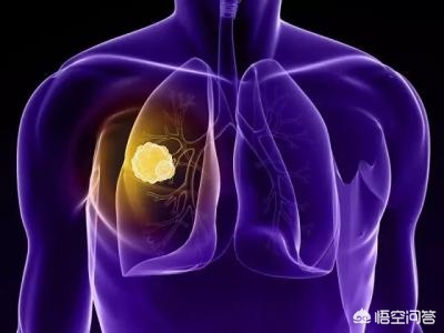 一天抽一包烟的人正常吗,一天抽一包烟还能活多久