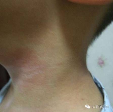 男子醒来躺在酒店,男子醉酒从酒店醒来逃跑