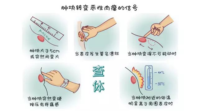 肉瘤良性和恶性误诊大不大,肉瘤为什么误诊为息肉