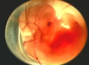 有先兆流产表现孕妈该怎么办,造成流产的5件事宝妈们要注意了