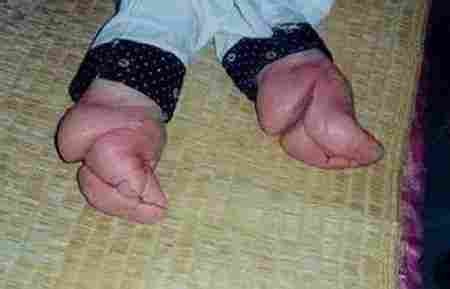 古代裹小脚真实过程,中国历史上的畸形审美