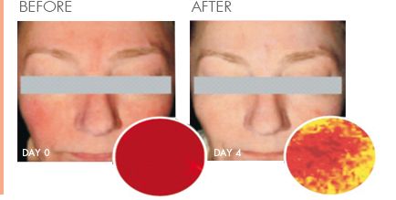 兜兜转转才发现是真爱,法国药妆和日本药妆