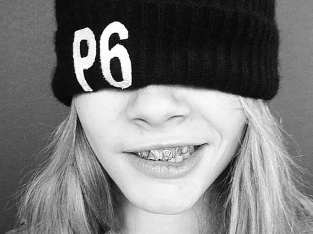 关于最近超火的金牙,你要知道这4件事(起码要知道怎么戴上去吧)