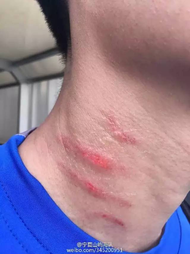 足球丨宁夏山屿海首次登顶榜首！谴责：沈阳球员竟然赛后下黑手！