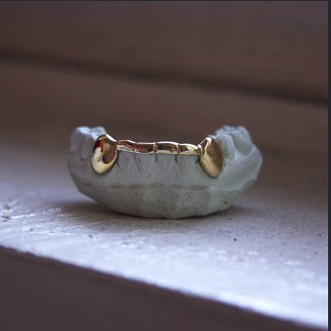 关于最近超火的金牙,你要知道这4件事(起码要知道怎么戴上去吧)