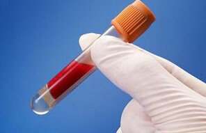 抽血导致皮下渗血怎么办,抽血后皮下淤血怎么处理