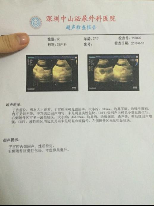 孕酮不涨流褐色物成功有胎心连医生都说是奇迹