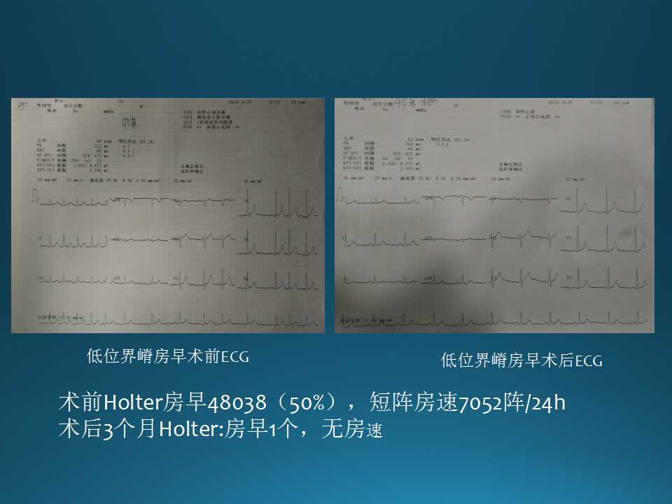 仁济医院射频消融王新华,王新华主要事迹