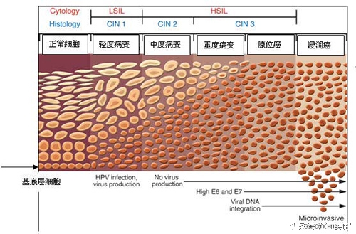 妇科宫颈癌疫苗,宫颈癌疫苗能预防哪些妇科病