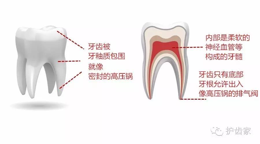 牙疼引起的牙疼怎么缓解,牙痛怎么办教你一招解决牙疼