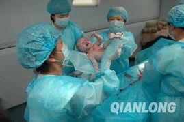 婴儿脐带绕颈迷信说法好吗,宝宝脐带绕颈导致缺氧生下来没哭