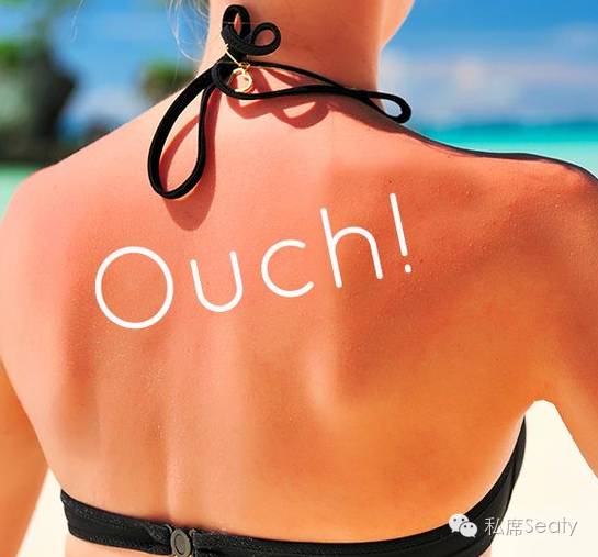 护肤眼睛疼怎么办,护肤晒伤后如何自救