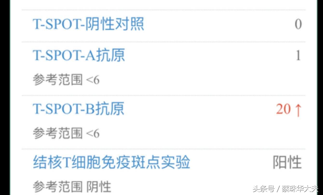 胎停查病理有用吗,胎停检查胚胎有用吗