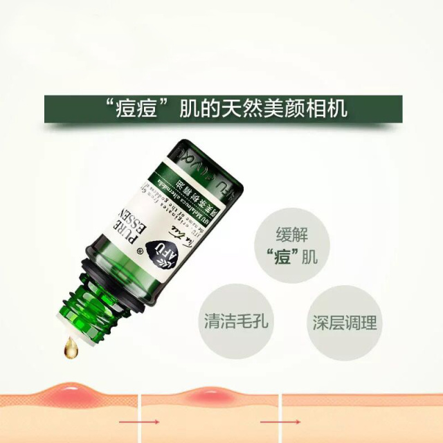 祛痘祛印产品推荐,真诚推荐祛痘产品